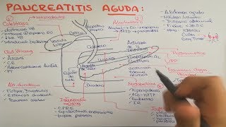 Pancreatitis causas fisiopatología clínica diagnóstico y tratamiento [upl. by Eram]