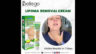 LIPOMA REMOVAL CREAM [upl. by Akisey790]