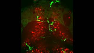 Microglia in the optic tectum at 10 dpf [upl. by Eeslek47]