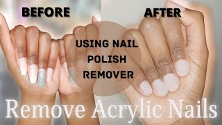 How to REMOVE ACRYLIC NAILS using NAIL POLISH REMOVER [upl. by Eenerb]