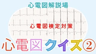 心電図解説場（心電図クイズ②） [upl. by Assirhc]