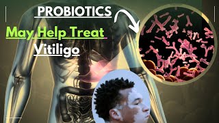 How Probiotics May Help Treat Vitiligo Naturally [upl. by Nerraw]