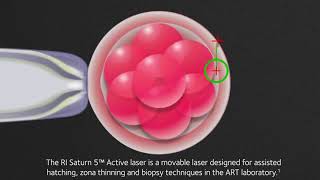 RI Saturn 5™ Active laser [upl. by Helaine]