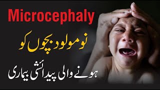 What Is The Microcephaly Condition  By Dr Khalid Jameel Akhtar [upl. by Conant]