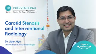 Carotid Stenosis Treatment with IR Minimally Invasive Approach Explained by a Dr Jigar Aiya [upl. by Sidoeht]