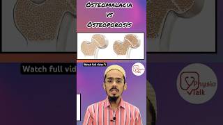 Osteomalacia vs osteoporosis  Difference between osteomalacia amp osteoporosis shorts [upl. by Mcnelly]