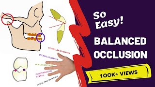 Balanced Occlusion Made Easy  PROSTHODONTICS [upl. by Eladnwahs184]