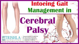 Intoeing Gait Management in Cerebral Palsy  Trishla Foundation [upl. by Ylera]