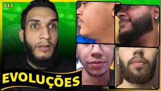 RESULTADOS COM MINOXIDIL evolução dos inscritos 113 [upl. by Patrich]