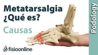 METATARSALGIA qué es CAUSAS SÍNTOMAS y TRATAMIENTO [upl. by Yesnel868]