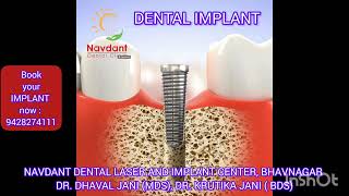 implant procedure animation dentalprocedure dentist fixedteeth bestdentalclinic bestdentist [upl. by Evelunn455]