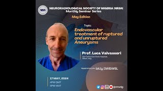 Prof Luca Valvassori Endovascular treatment of ruptured and unruptured Aneurysms  May24 [upl. by Amlez52]