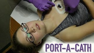 HOW TO ACCESS A PORTACATH IMPLANTED PORT [upl. by Nisaj]