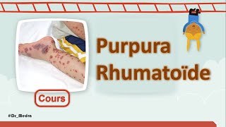 Enfant avec tâches purpuriques cutanées👶  📚 Purpura Rhumatoïde  Cours  Pédiatrie [upl. by Otreblig]