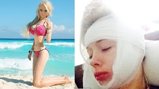 Human Barbie Assaulted Outside Her House [upl. by Aid211]