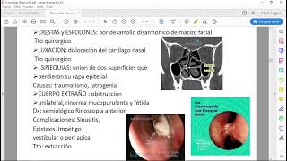 Repasso de Otorrino P2  Flávio Oliveira [upl. by Aruol897]