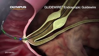 GLIDEWIRE Endoscopic Hydrophilic Coated Guidewire Animation [upl. by Whetstone298]