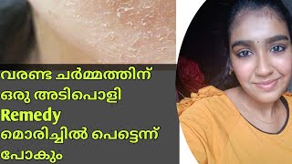 വരണ്ട ചർമം അകറ്റാൻ Get Rid Of Dry Skin Naturally At HomeMalayalam [upl. by Zane473]