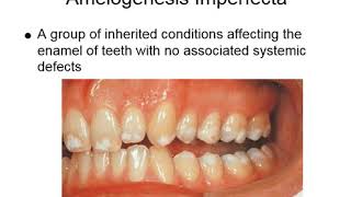 Oral Manifestations of Genetic Abnormalities  Oral Pathology Lecture Ch 6 Pt 2 [upl. by Casilde]