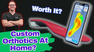 Are Custom Orthotics Worth It Plantar Fasciitis amp Flat Feet [upl. by Anil]