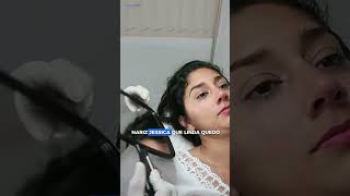 Mejora tu nariz sin cirugía y en minutos 🤩 rinomodelacion belleza cirugiadenariz rinoplastia [upl. by Atteuqal980]