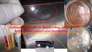 Salmonella growth on Macconkey oxidase test Antibiogram pattern and Serotyping [upl. by Pedrick133]