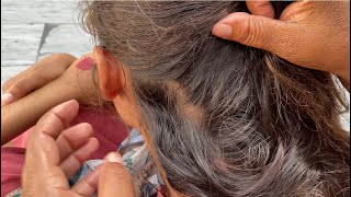 Mom lice’s picking best video 🤪How to remove lice school girl 🥵mother head lice picking 2 [upl. by Plume933]