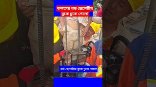 কলমের রড ছেলেটির বুকে ঢুকে গেলোconcrete construction working plan work shorts viral trending [upl. by Accebber]