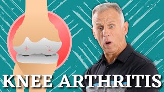 5 Proven Exercises for Knee Osteoarthritis or Knee Pain Do it Yourself [upl. by Kcirtapnhoj]