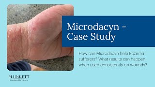 Microdacyn Hydrogel Case Study  the sting free wound care spray that helps reduce infection [upl. by Nosrak]