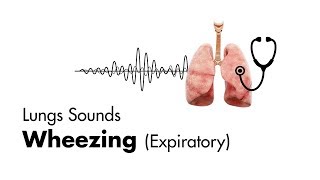 Wheezing expiratory  Lung Sounds  MEDZCOOL [upl. by Aisiat]