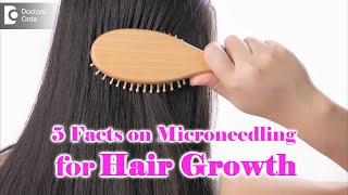 5 Things to Know about Microneedling for Hair Growth  Dr Divya SharmaDoctors Circle [upl. by Anitsahs811]