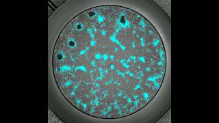 Segmentation and Analysis of Colony Formation in Dish Containers [upl. by Tidwell135]