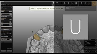 Workflow example from archive to nesting 2015 Modellier version  ZirkonzahnSoftware [upl. by Foulk]