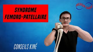 Soigner efficacement le syndrome fémoro patellaire  Conseil KINE et autoexercices [upl. by Jamima546]