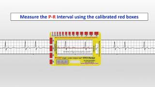 EKG Concepts  RCAT Badge  Interpreting EKG Rhythms [upl. by Hanfurd]