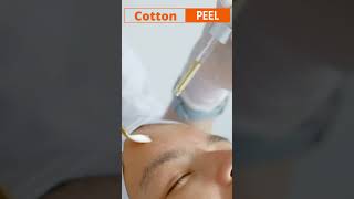 Chemical Peel  Cotton Peel  DTCSKINCLINIC [upl. by Edana]