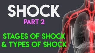 Stages of Shock  Types of Shock  Shock Part 2 [upl. by Bruning]