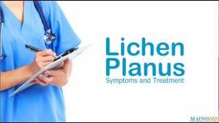 Lichen Planus Symptoms and Treatment [upl. by Akiret]