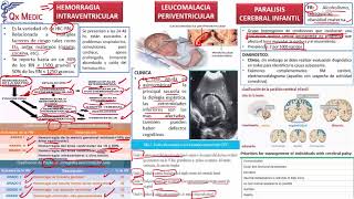 10 COMPLICACIONES LEUCOMALACIA PERIVENTR PARALISIS CEREBRAL INFANTIL [upl. by Colis]