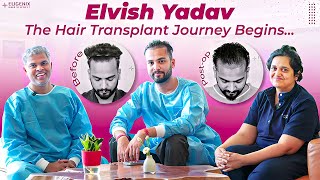 Unlocking Celebrity Hair Transplant Secrets Elvish Yadavs Eugenix Experience [upl. by Trask]