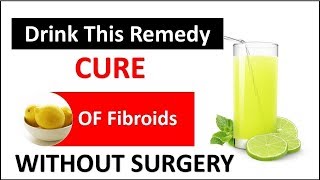 How To Get Rid Of Large Fibroid Natural At Home  Fibroid Fast treatment [upl. by Aiasi]