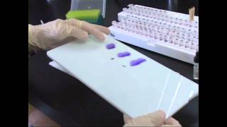 Testing Eggs for Salmonella at UMaine [upl. by Jeffers793]