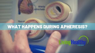 Managing Cholesterol With Apheresis [upl. by Ydorb]