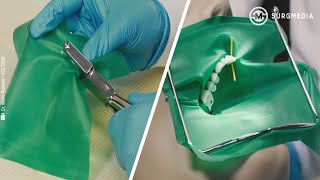 Basics of Dental Rubber Dam Placement [upl. by Ylreveb9]