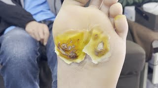 Pedicure Tutorial：Gently repairs the soles of the feet [upl. by Piotr559]