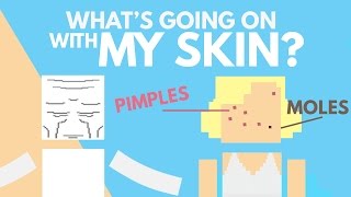 The Science of Pimples Wrinkles and Moles [upl. by Doniv448]