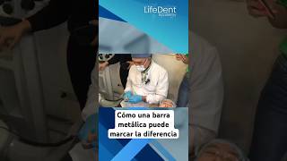 prostodoncia dentista protesisdental protesisdentales protesista [upl. by Atoiganap267]