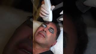 Dr Nassif Receives BBL amp MOXI Laser Treatments [upl. by Darrow]