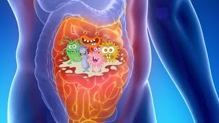 Small Intestinal Bacterial Overgrowth Updates and Clinical Implications [upl. by Gardal574]